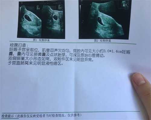 北京代孕哪家正规_北京代孕的方式_剖腹产后月经量多是什么原因