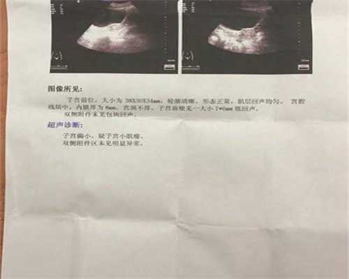 民营供卵试管机构_北京去哪里做供卵不用等_怀孕三个多月能不能吃猪肝